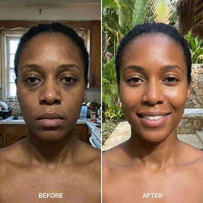 LumiFace Pro — skin tightening